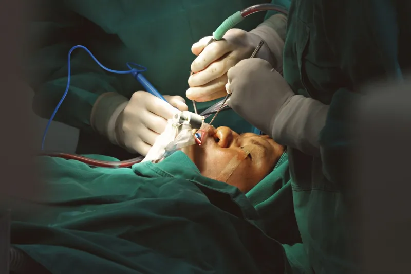 He Woke Up With a Stranger's Face. His Wife Woke Up With a Stranger's Husband.